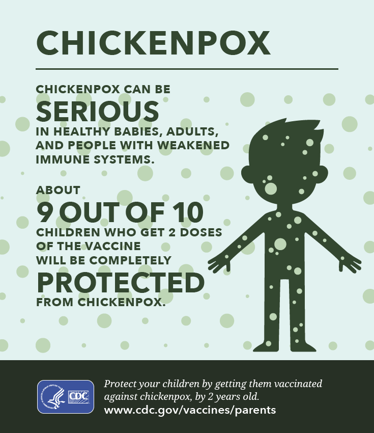 Chickenpox 3
